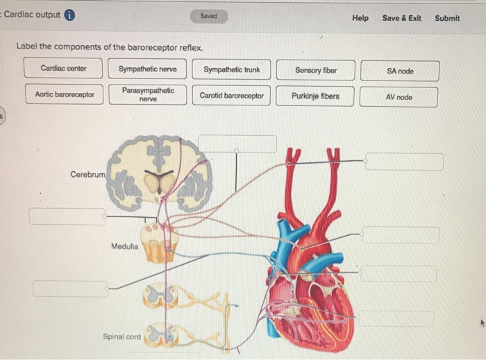 Label the components of the baroreceptor reflex.